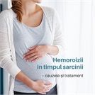 Hemoroizii în timpul sarcinii