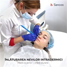 Înlăturarea nevilor intradermici