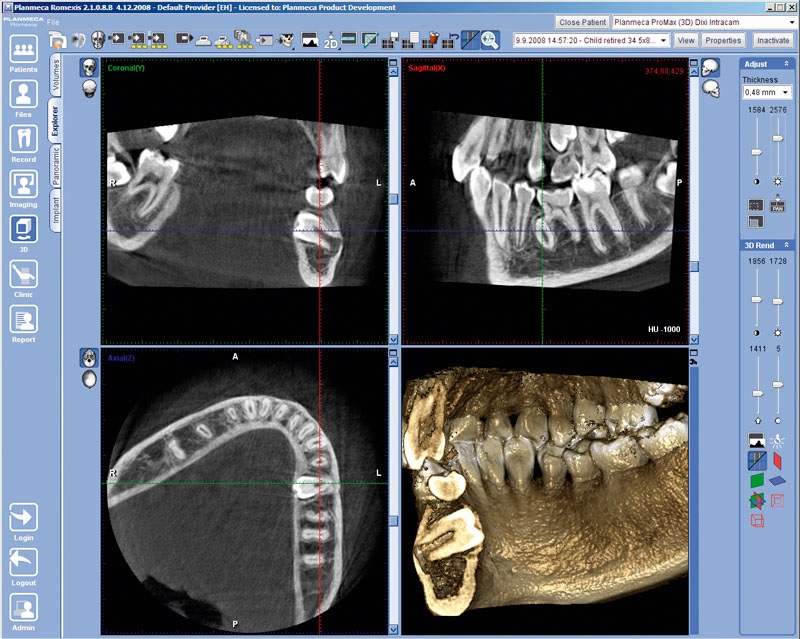 Интерфейс мрт ge. Снимки в формате dicom кт. Дентальная компьютерная 3d-томография схема. Планмека кт программа. Томография 3д программа.